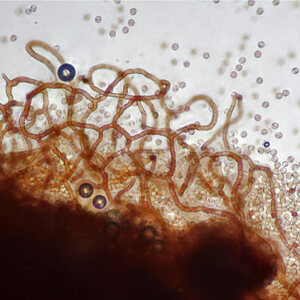 Arcyria ferruginea threads with cogs