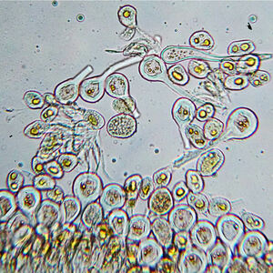 Melampsora caprearum paraphyses and spores_1000