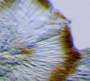 Sarcogyne regularis ascus x 400-Bowlees 
