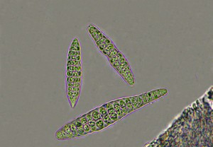 Thelotrema lepidinum spores x 400